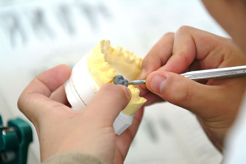 腕のある技工士さんがオーダーメイドで製作