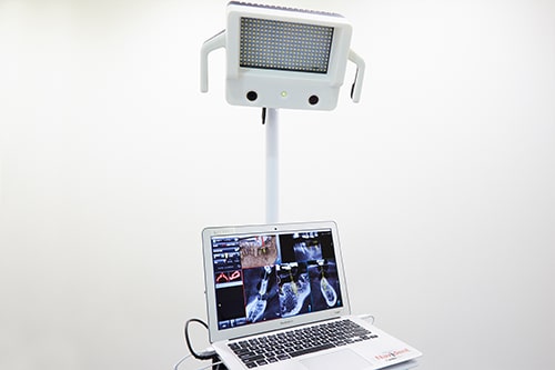 3Dインプラントで行う治療計画のシミュレーション